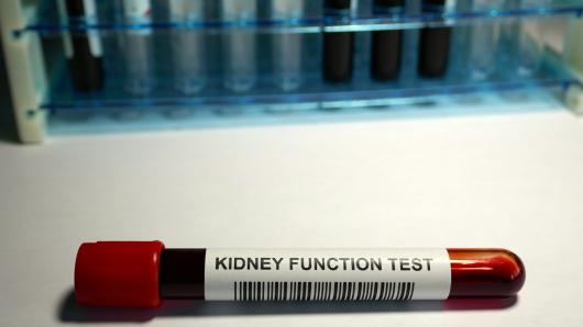 Image of a kidney function test tube on a white surface. 
