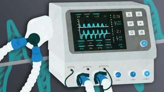 Mechanical Ventilation For Covid 19 Harvard University Mechanical Ventilation For Covid 19 Harvard University